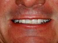Konig Center for Cosmetic & Comprehensive Dentistry smile photos